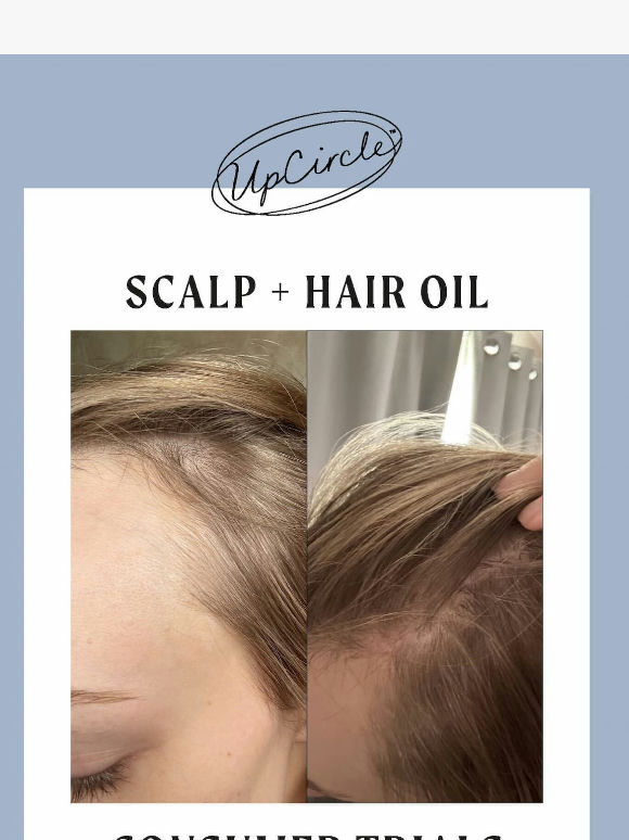 UpCircler, The Hair Oil Results Are In 🤯